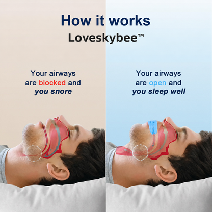 Loveskybee™  Professional intelligent anti-snoring device